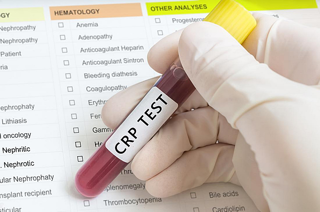 Prečo sa oplatí mať doma CRP test