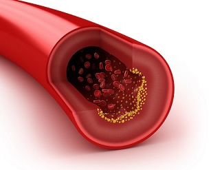 Všetko čo by ste mali vedieť o cholesterole